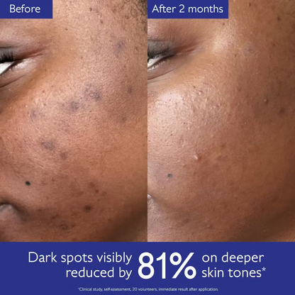 Caudalie Vinoperfect Brightening Dark Spot Serum Vitamin C Alternative